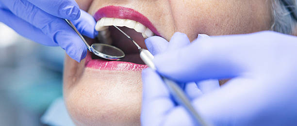Best Chipped Tooth Repair Near Me  in Flying Hills, PA